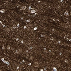 Immunohistochemical staining of human cerebral cortex shows positivity in neuropil.
