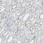 Immunohistochemical staining of human kidney shows very weak cytoplasmic positivity.