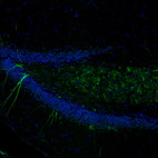 Immunofluorescence staining of mouse brain shows moderate positivity in of in the hippocampus.