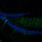 Immunofluorescence staining of mouse brain shows moderate positivity in of in the hippocampus.