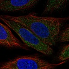 Immunofluorescent staining of human cell line SiHa shows localization to cytosol.