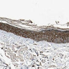 Immunohistochemical staining of human skin shows strong granular cytoplasmic positivity in squamous epithelial cells.