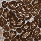 Immunohistochemical staining of human kidney shows strong cytoplasmic positivity in cells in tubules.