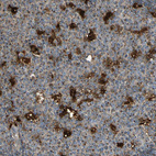 Anti-GM2A Antibody