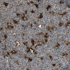 Immunohistochemical staining of human lymph node shows strong granular cytoplasmic positivity in germinal center cells.