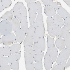 Immunohistochemical staining of human skeletal muscle shows no positivity in myocytes as expected.