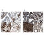 Immunohistochemical staining of human fallopian tube, gastrointestinal, prostate and testis using Anti-CALD1 antibody HPA008066 (A) shows similar protein distribution across tissues to independent antibody HPA017330 (B).