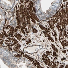 Immunohistochemical staining of human prostate shows strong cytoplasmic positivity in smooth muscle cells.