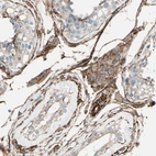 Immunohistochemical staining of human testis shows strong cytoplasmic positivity in peritubular myoid cells.