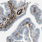Immunohistochemical staining of human fallopian tube shows strong cytoplasmic positivity in smooth muscle cells and blood vessles.