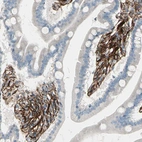Immunohistochemical staining of human duodenum shows strong cytoplasmic positivity in smooth muscle cells.
