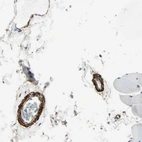 Immunohistochemical staining of human skeletal muscle shows moderate cytoplasmic positivity in smooth muscle cells.