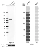 Western blot analysis in human cell lines U-251MG and MCF-7 using Anti-CALD1 antibody. Corresponding CALD1 RNA-seq data are presented for the same cell lines. Loading control: Anti-GAPDH.