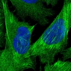 Immunofluorescent staining of human cell line U-2 OS shows localization to plasma membrane & actin filaments.