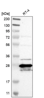Western blot analysis in human cell line RT-4.