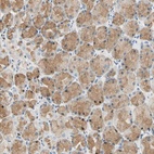 Anti-LAMB3 Antibody