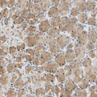 Anti-LAMB3 Antibody