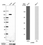 Western blot analysis in human cell lines A-431 and MCF-7 using Anti-LAMB3 antibody. Corresponding LAMB3 RNA-seq data are presented for the same cell lines. Loading control: Anti-GAPDH.