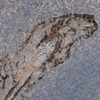 Immunohistochemical staining of human Tonsil shows strong membranous positivity in squamous epithelial cells.