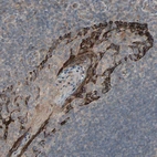 Immunohistochemical staining of human Tonsil shows strong membranous positivity in squamous epithelial cells.