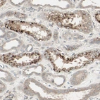 Immunohistochemical staining of human Kidney shows moderate granular cytoplasmic positivity in cells in distal tubules.