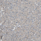 Immunohistochemical staining of human Pancreas shows no membranous positivity in exocrine glandular cells.