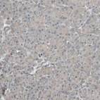 Immunohistochemical staining of human Pancreas shows no membranous positivity in exocrine glandular cells.