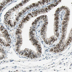 Immunohistochemical staining of human fallopian tube shows moderate nuclear positivity in glandular cells.