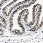 Immunohistochemical staining of human fallopian tube shows moderate nuclear positivity in glandular cells.