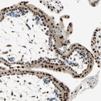 Immunohistochemical staining of human placenta shows strong nuclear positivity in trophoblastic cells.