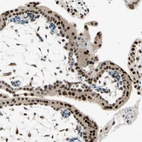 Immunohistochemical staining of human placenta shows strong nuclear positivity in trophoblastic cells.