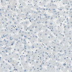 Immunohistochemical staining of human liver shows no positivity in hepatocytes as expected.