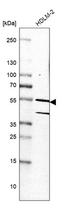 Western blot analysis in human cell line HDLM-2.