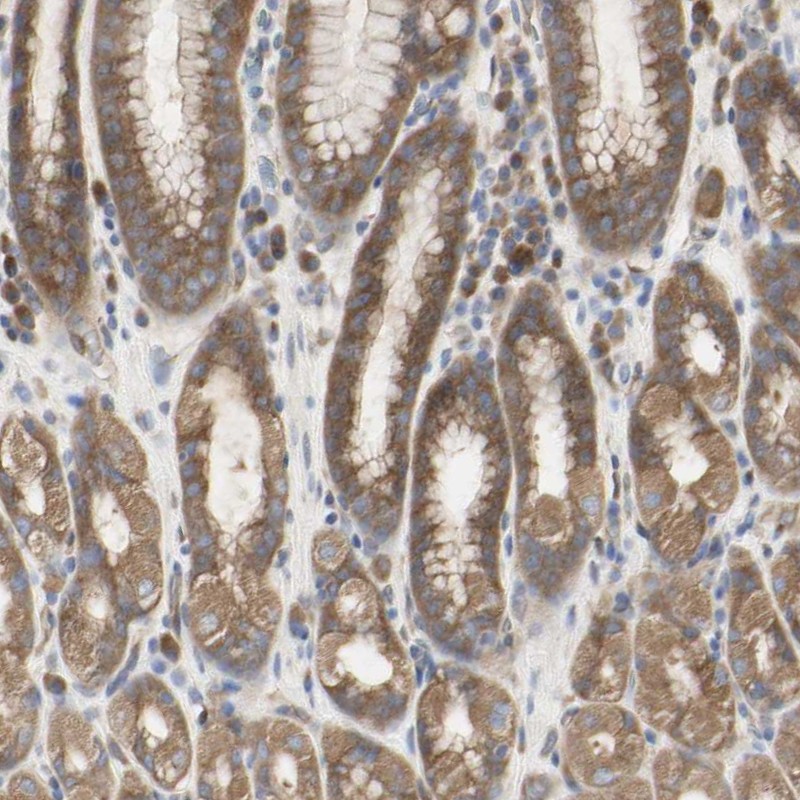 Anti-C3orf52 Antibody