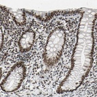 Anti-HMG20A Antibody