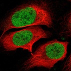 Immunofluorescent staining of human cell line U-2 OS shows localization to nucleus.