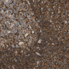 Immunohistochemical staining of human lymph node shows strong positivity.