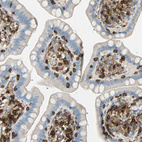 Immunohistochemical staining of human small intestine shows cytoplasmic positivity.