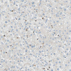 Immunohistochemical staining of human liver shows moderate cytoplasmic positivity in Kupffer cells.