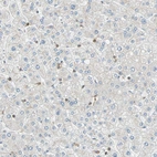 Immunohistochemical staining of human liver shows moderate cytoplasmic positivity in Kupffer cells.