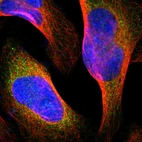 Immunofluorescent staining of human cell line U-2 OS shows localization to cytosol.