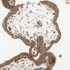 Immunohistochemical staining of human placenta shows strong granular cytoplasmic positivity in trophoblastic cells.