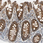Immunohistochemical staining of human colon shows strong granular cytoplasmic positivity in glandular cells.