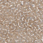 Immunohistochemical staining of human liver shows strong granular cytoplasmic positivity in hepatocytes.