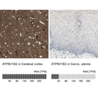Anti-ATP6V1B2 Antibody