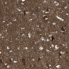 Immunohistochemical staining of human cerebral cortex shows strong cytoplasmic positivity in neuropil.