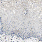 Immunohistochemical staining of human cervix, uterine shows no cytoplasmic positivity in squamous epithelial cells as expected.