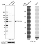 Western blot analysis in human cell lines SK-MEL-30 and MCF-7 using Anti-ATP6V1B2 antibody. Corresponding ATP6V1B2 RNA-seq data are presented for the same cell lines. Loading control: Anti-PFN1.
