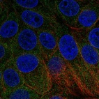 Immunofluorescent staining of human cell line MCF7 shows localization to endoplasmic reticulum.