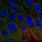 Immunofluorescent staining of human cell line MCF7 shows localization to endoplasmic reticulum.